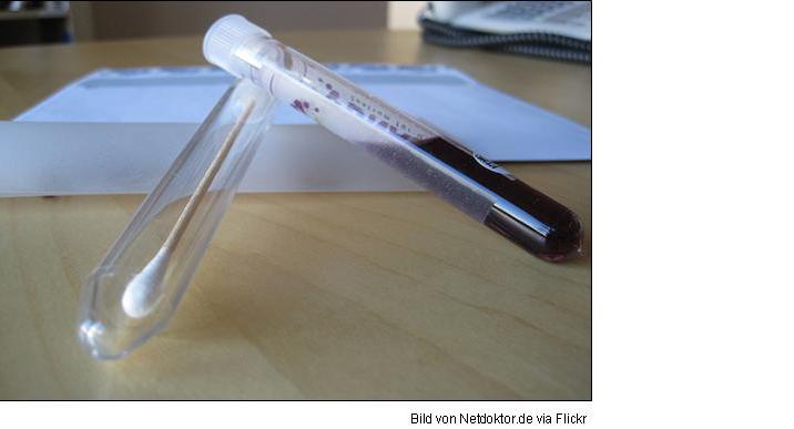 Bild von Netdoktor.de via flickr (https://www.flickr.com/photos/netdoktorde/4400259753/in/photolist-7GQzhF-7H5yuk-DPKMez-7H53oK-avuZDt-7H98ao-7GUdSw-7GQSR6-7GQJpg-7H5yuc-7GQJpc-7GUdSo-7GQtVP-7H5yuH-8H6RGj-8H3HpP-61Ui8t-8H6Pid-7GQtVn-7GQtVt-7GQSR2-dr7Bzf-7GQtVD-7GQSRa-7GQtVH-83cTV1-7GQSQV-4UFSuE-bkTHmB-moijfr-ypS9s6-6zoAvi-839Hbg-9YehfZ-9L5TyB-a142rr-as179N-9Pj1kk-9EgBPd-arpfRQ-MQbp24-L6gJNB-ypS9uR-ynq85G-xH9R6t-wUehpa-6j3fT5-3PVSpt-7GUyru-a9Cnjj)